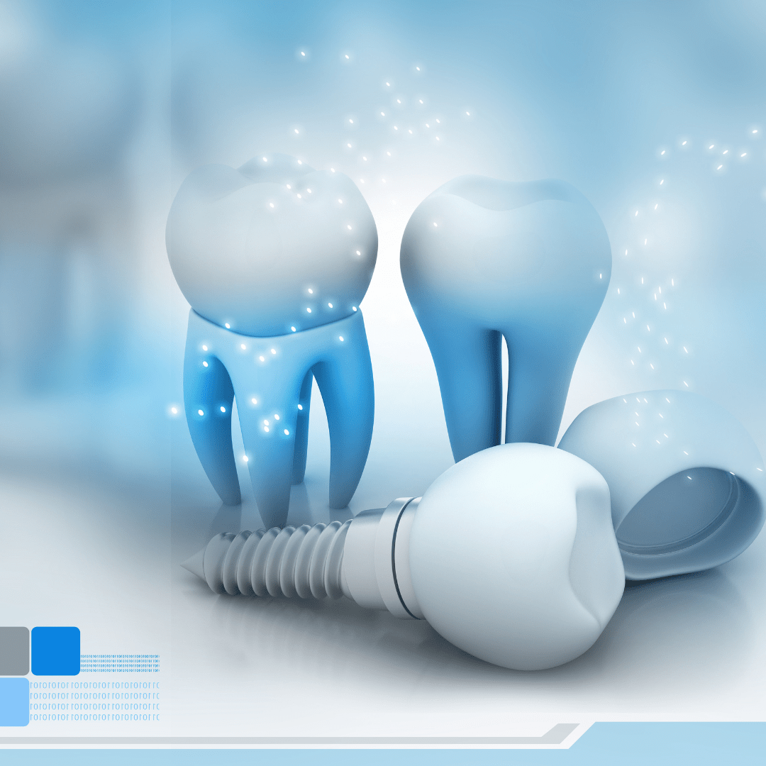 You Are Currently Viewing Dental Implants Vs. Traditional Dentures: Making The Right Choice