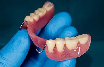 Dentures2 Casa Dental