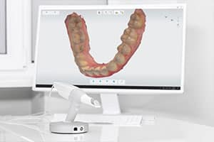 Digital Scanner Casa Dental