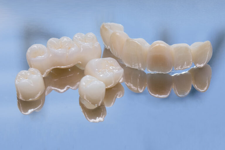 Smaller Image Dental Crown Bridge Dental Crown