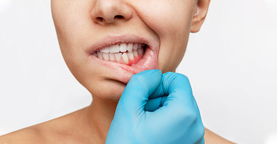 What Causes Bleeding Gums And When To See A Dentist