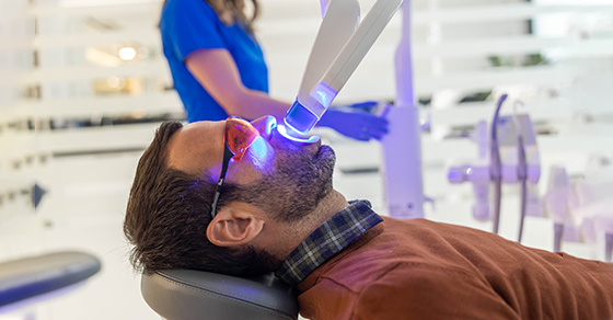 Why Professional Teeth Whitening Is Safer And More Effective