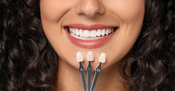 Dental Veneers Vs. Crowns: Which Option Is Right For You?